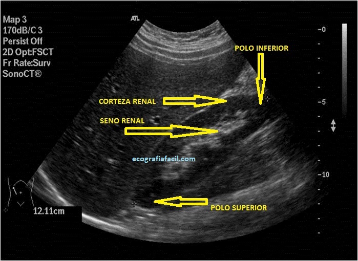 51. Protocolo de Abdomen. Riñón Derecho. – Ecografía Fácil